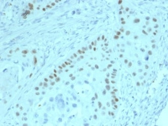 IHC staining of FFPE human prostate tissue with p63 antibody (clone PCRP-TP63-2G3). HIER: boil tissu