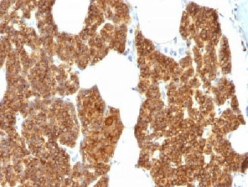 Parathyroid Hormone Antibody / N Terminal