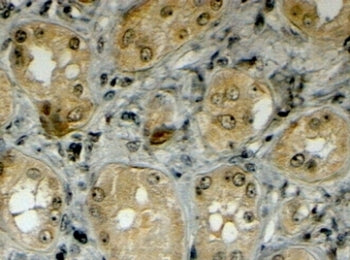 IHC testing of FFPE human kidney with LRP5 antibody at 4ug/ml. HIER: steamed with pH6 citrate buffer