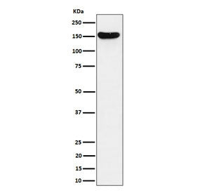 Western blot testing of human Jurkat cell lysate with VGL antibody. Predicted molecular weight ~141 