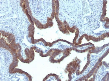 KRT7 Antibody / Cytokeratin 7