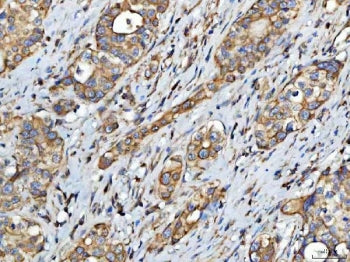 FATP-4 Antibody / ACSVL4 / SLC27A4