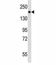 PDGFR antibody western blot analysis in mouse NIH3T3 lysate. Expected molecular weight: 123-190 kDa 