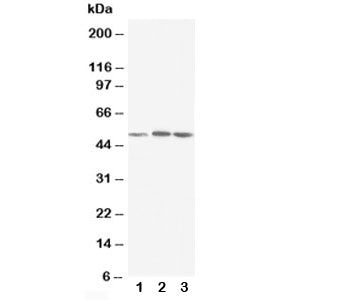 Western blot testing of NR1H3 antibody and Lane 1: rat liver; 2: MCF-7; 3: HeLa cell lysate