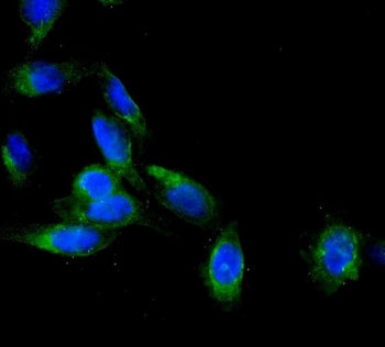 AEBP2 Antibody