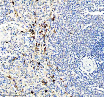 Immunohistochemical staining of IL21R using anti-IL21R antibody. IL21R was detected in a paraffin-em