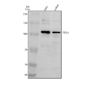 Western blot analysis of TTLL5 using anti-TTLL5 antibody. Electrophoresis was performed on a 8% SDS-