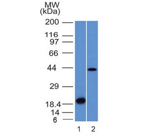 Aurora B Antibody / AURKB