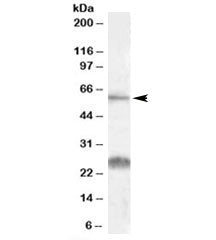 Western blot testing of human kidney lysate with SLC47A1 antibody at 0.1ug/ml. The expected ~60kDa b