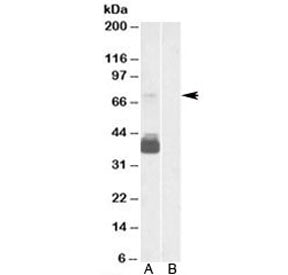 Western blot testing of human brain frontal cortex lysate with P2RX7 antibody at 0.3ug/ml with [B] a