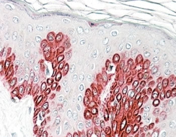 IHC staining of FFPE human skin with Sirtuin 1 antibody at 4ug/ml. HIER: steamed with pH6 citrate bu
