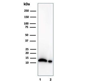 Macrophage Migration Inhibitory Factor Antibody / MIF