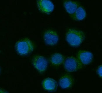 Immunofluorescent staining of FFPE human SiHa cells with CYP7A1 antibody (green) and DAPI nuclear st