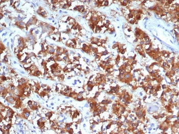 IHC staining of FFPE human adrenal gland tissue with IL18R1 antibody (clone IL18R1/7591). HIER: boil