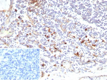 IHC staining of FFPE human tonsil tissue with recombinant IL3RA antibody (clone rIL3RA/9212). Inset: