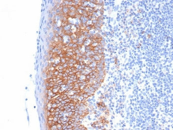 IHC staining of FFPE human tonsil tissue with Syndecan-1 antibody (clone SDC1/7178). HIER: boil tiss