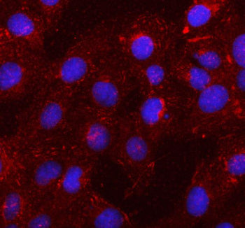Immunofluorescent staining of SSH1 using anti-SSH1 antibody (red). SSH1 was detected in an immunocyt