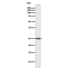 Western blot testing of human SH-SY5Y cell lysate with PGP9.5 antibody. Predicted molecular weight ~