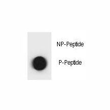 Dot blot analysis of phospho-TSC1 antibody. 50ng of phos-peptide or nonphos-peptide per dot were spo