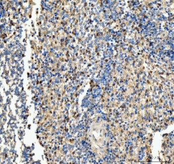 IHC staining of FFPE human spleen tissue with CD63 antibody. HIER: boil tissue sections in pH8 EDTA 