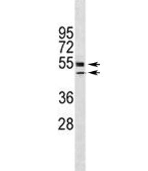 VDR antibody western blot analysis in HL-60 lysate. Predicted molecular weight 48/54 kDa (isoforms 1