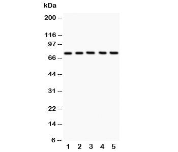 Western blot testing of 12 Lipoxygenase antibody and Lane 1: A549; 2: MCF-7; 3: COLO320; 4: Jurkat; 