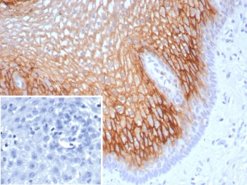 SBSN Antibody / Suprabasin