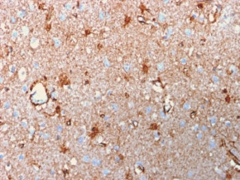 IHC testing of FFPE human brain with recombinant S100B antibody (clone rS100B/1896). HIER: steam sec