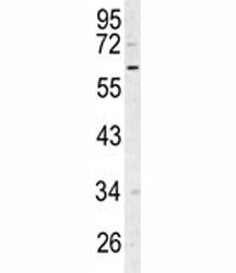 RIPK3 Antibody