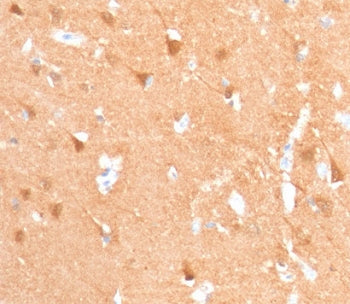 IHC staining of FFPE human cerebellum with recombinant UchL1 antibody (clone rUBCE-L1). Required HIE