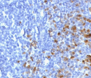 IHC staining of FFPE human tonsil tissue with recombinant IgG antibody (clone GHC07-2R). Required HI