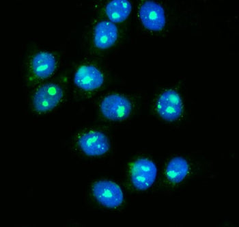 Immunofluorescent staining of FFPE human MCF7 cells with GAR1 antibody (green) and DAPI nuclear stai