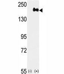 Western blot analysis of anti-HER2 antibody and 293 cell lysate (2 ug/lane) either nontransfected (L