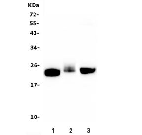 Western blot testing of 1) rat brain, 2) rat thymus and 3) mouse brain lysate with CD90 antibody. Ex