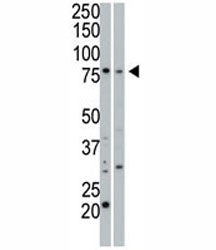 cGKI beta antibody used in western blot to detect cGKIbeta in 293 cell lysate (Lane 1) and mouse sma