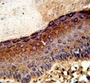 IHC testing of FFPE human skin tissue with UDP-glucose 4-epimerase antibody. HIER: steam section in 