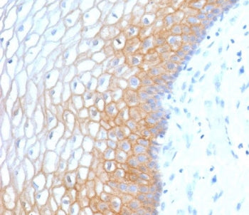Formalin-fixed, paraffin-embedded human cervix stained with recombinant E-Cadherin antibody (clone E