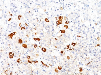 TSH beta Antibody / TSHB