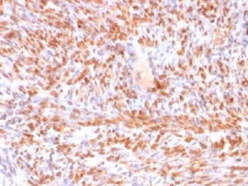 IHC testing of FFPE human uterus stained with recombinant Calponin antibody (clone rCNN1/832). Requi