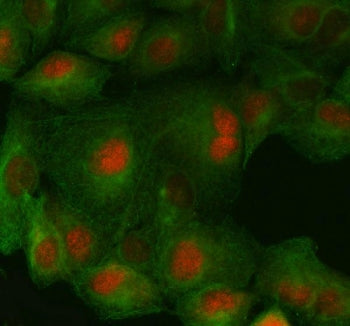 FAF1 Antibody / FAS-associated factor 1