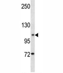 DOG1 antibody western blot analysis in human K562 lysate. Expected molecular weight 74-114 kDa but m