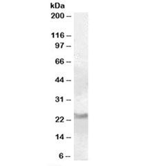 Western blot testing of human cerebellum lysate with RAB8A antibody at 0.1ug/ml. Predicted molecular