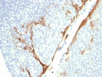 KRT16 Antibody / Cytokeratin 16