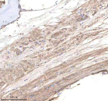 IHC staining of zebrafish Pi4kb protein using Zebrafish Pi4kb antibody, HRP-labeled secondary and DA