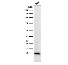 Western blot testing of human Raji cell lysate with Ubiquitin antibody (clone UBB/1748). Expected mo
