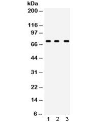 Western blot testing of human 1) MCF7, 2) A549 and 3) PANC lysate with ABCG5 antibody. Expected/obse