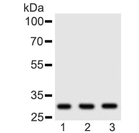 Western blot testing of human 1) placenta, 2) HeLa and 3) Jurkat lysate with Adiponectin antibody at