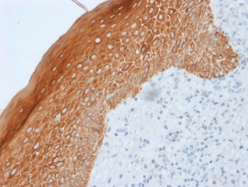 IHC staining of FFPE human skin with Cytokeratin 5/6/18 antibody (clone LP34). HIER: boil tissue sec