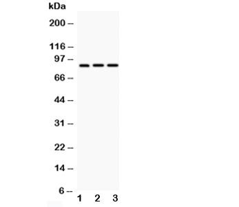 Western blot testing of CD18 antibody and Lane 1: HeLa; 2: Jurkat; 3: HT1080; Predicted/Observed mol