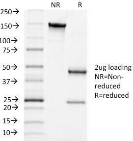 hCG Receptor / LH Receptor Antibody
